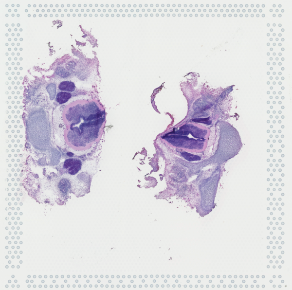 Cervical and Thoracic (week 7)