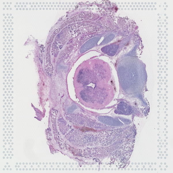 Cervical (week 9)