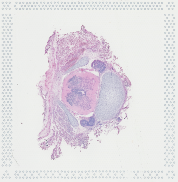 Lumbar (week 9)