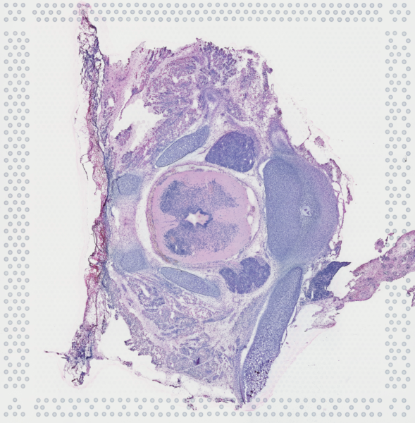 Thoracic (week 9)
